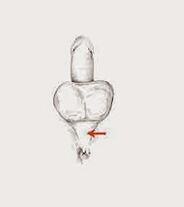 svaly potencie a ich napätie na zvýšenie potencie