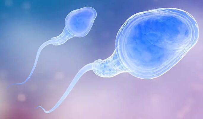 V mužskom preejakuláte môžu byť prítomné spermie
